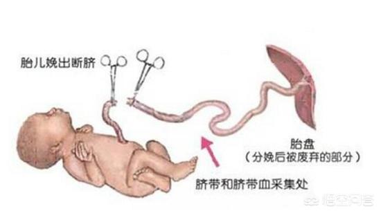 今日科普一下！女孩做隆鼻后死亡,百科词条爱好_2024最新更新