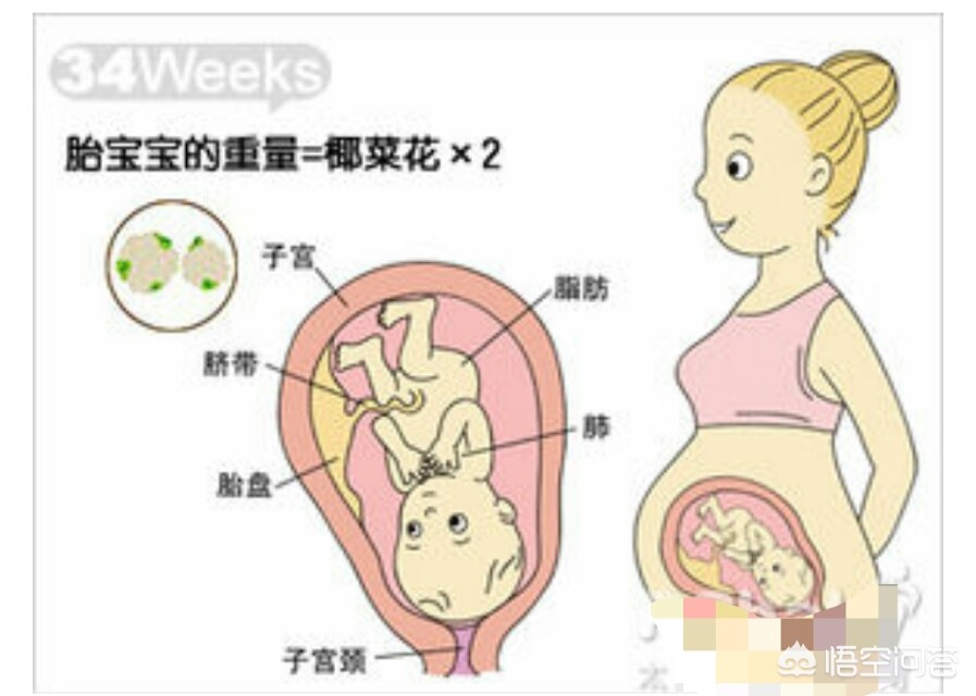 今日科普一下！看高血压查出孕34周,百科词条爱好_2024最新更新