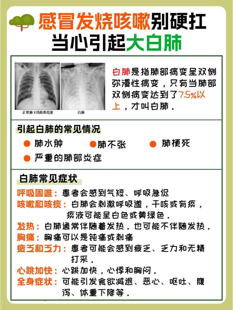 今日科普一下！感染流感几天现白肺,百科词条爱好_2024最新更新